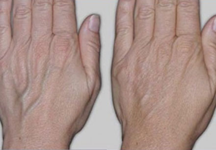 Before and After